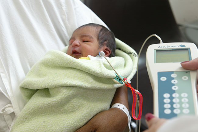 Teste da orelhinha é rápido e indolor para o bebê (foto: divulgação)